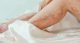 O que é vasculite cutânea e como ela pode atingir rins, pulmões e nervos - pexels