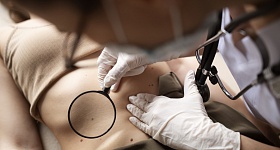    Erros repetidos no dia a dia e busca por bronzeamento impulsionam casos de câncer de pele no Brasil - Divulgação: FreePik