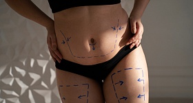 A popularização das canetas emagrecedoras levanta novos debates sobre segurança, timing cirúrgico e resultados em procedimentos de cirurgia plástica - Crédito: Freepik