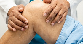  Clinica EV Citi _ Lúpus - divulgação