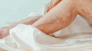 O que é vasculite cutânea e como ela pode atingir rins, pulmões e nervos - pexels