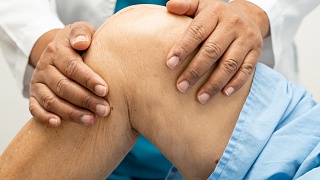  Clinica EV Citi _ Lúpus - divulgação