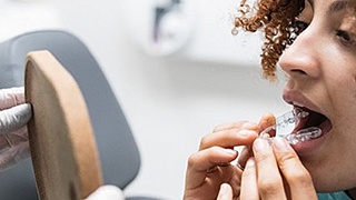     Divulgação ClearCorrect