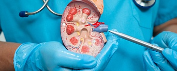  A alta demanda tem relação direta com a incidência crescente de doenças crônicas, especialmente a hipertensão arterial e o diabetes, que podem levar à perda progressiva da função renal - Crédito: Envato