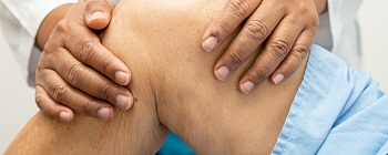  Clinica EV Citi _ Lúpus - divulgação