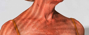 Divulgação / Freepik