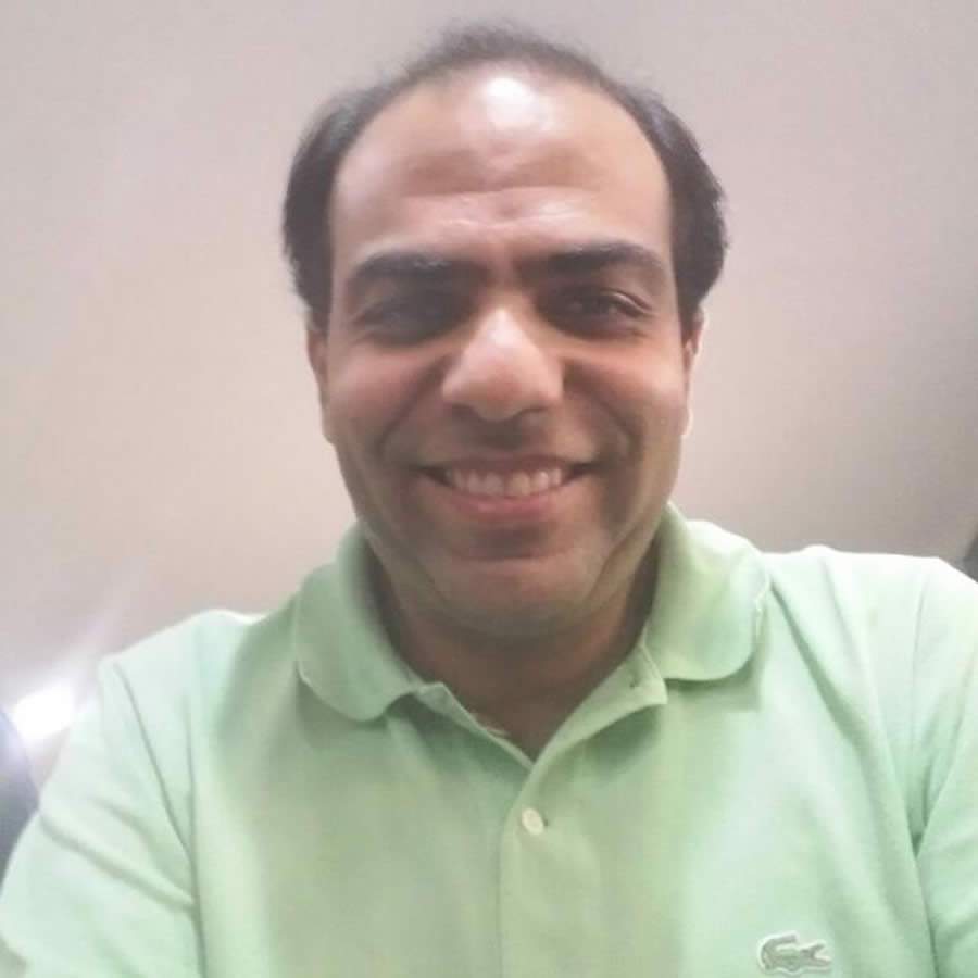 Por que os ERPs n&atilde;o calculam a margem de contribui&ccedil;&atilde;o?