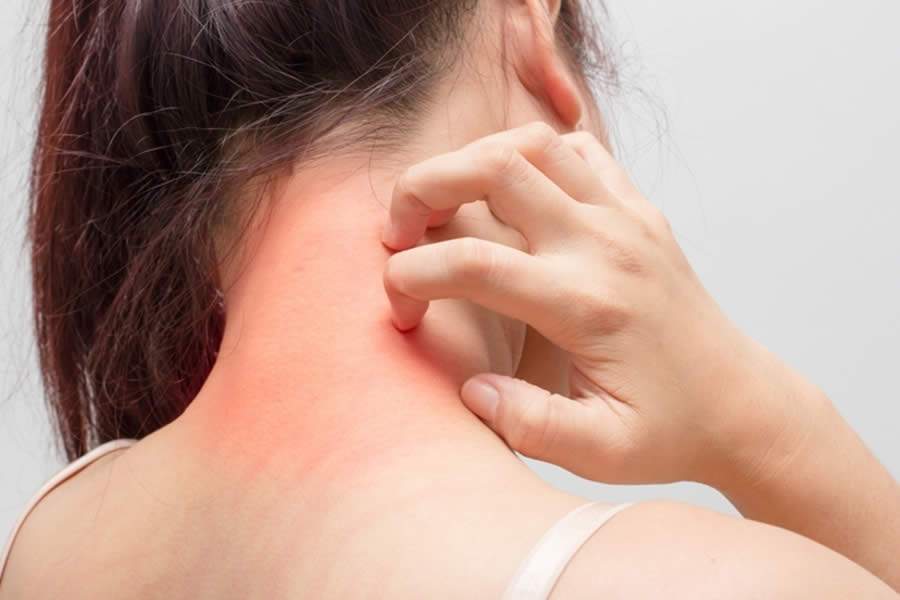 Quase 65% dos portadores de doenças na pele não procuram médico, diz estudo europeu