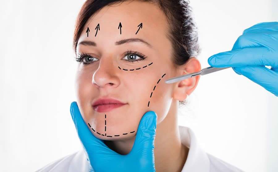 Cirurgia do queixo é alternativa definitiva para harmonização facial e preenchimentos contínuos