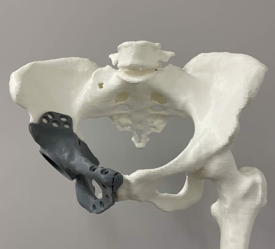 HSP - Cirurgia - Andre Ferrari_bx