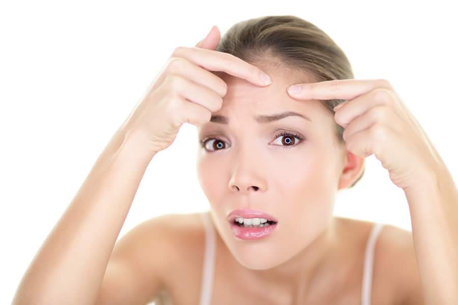 Apesar de comum, acne não é inofensiva e pode deixar marcas, cicatrizes e manchas na pele