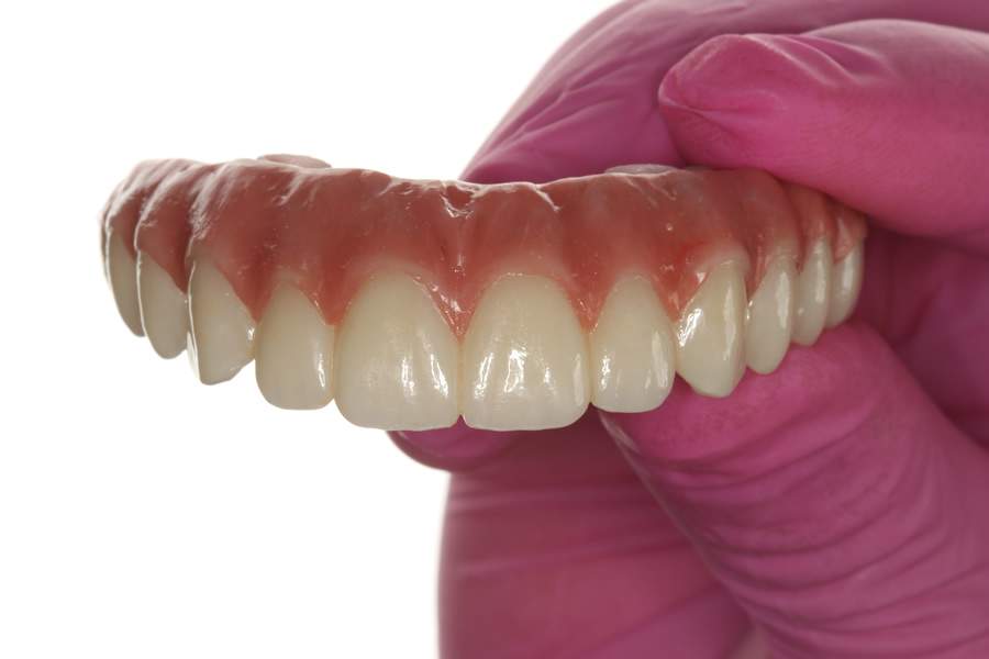 Odontologia digital traz agilidade para dentistas e pacientes - Foto reprodu&ccedil;&atilde;o -Implo