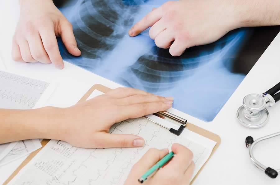 Pneumonia tem diferentes origens e inverno apresenta maior incid&ecirc;ncia