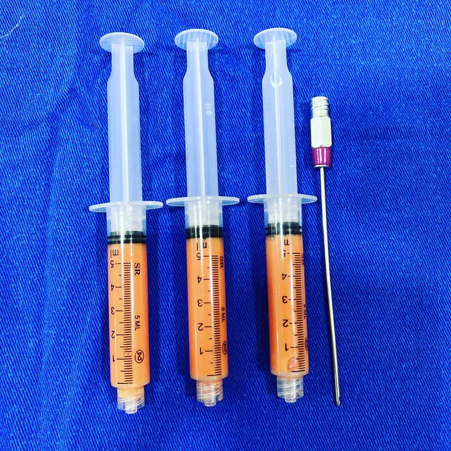 Lipoenxertia: t&eacute;cnica ajuda a moldar o corpo e &eacute; usada nas cirurgias reconstrutivas e est&eacute;ticas