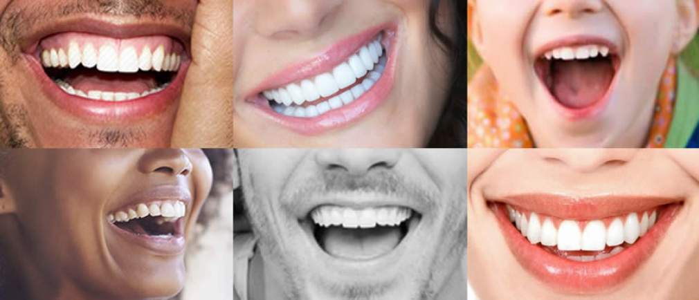 Especialista explica quais tratamentos necessários para obter um sorriso saudável e bonito