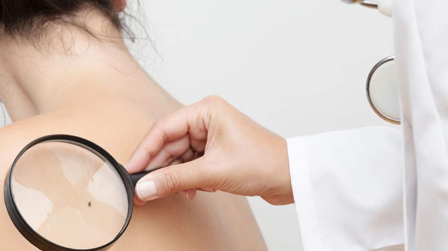 Dezembro Laranja: Combate e Preven&ccedil;&atilde;o do C&acirc;ncer de Pele