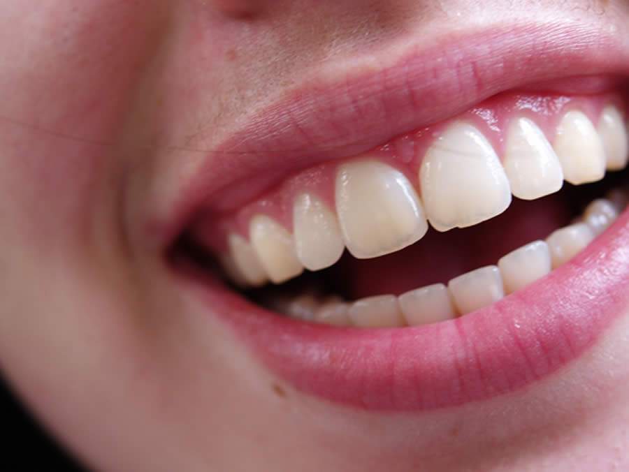 Tudo o que você precisa saber para manter a saúde oral em dia e conquistar um sorriso mais bonito