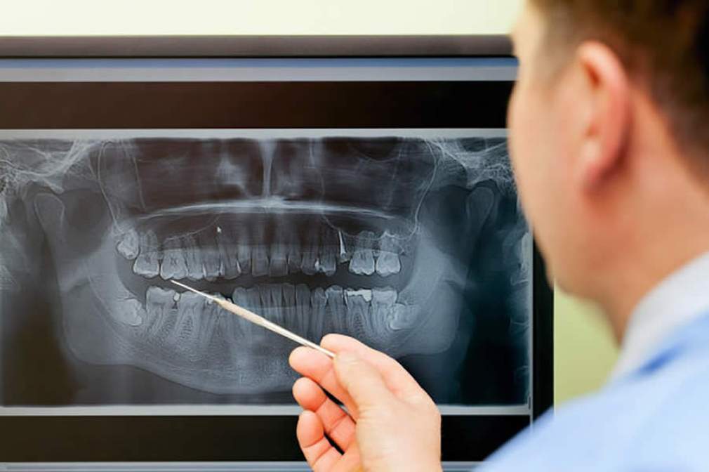 Osteoporose & dentição - Crédito: Reprodução