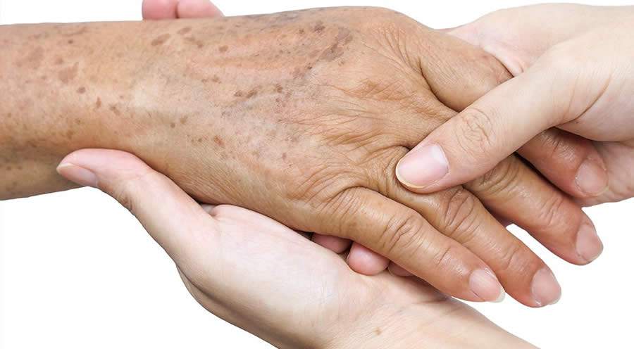 Entenda como se formam as pequenas manchas que surgem com a idade devido à exposição solar