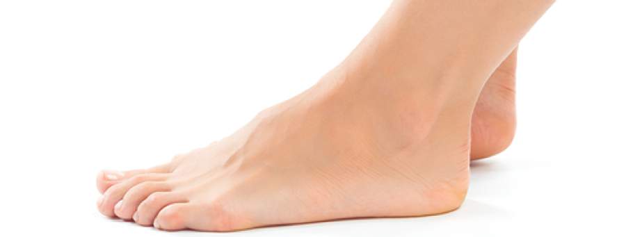 Ter Pés Chatos Pode Ser Problema?