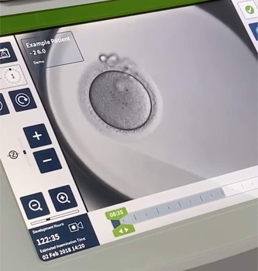 Fertiliza&ccedil;&atilde;o in vitro: tecnologia in&eacute;dita na Am&eacute;rica Latina oferece mais seguran&ccedil;a ao desenvolvimento do embri&atilde;o