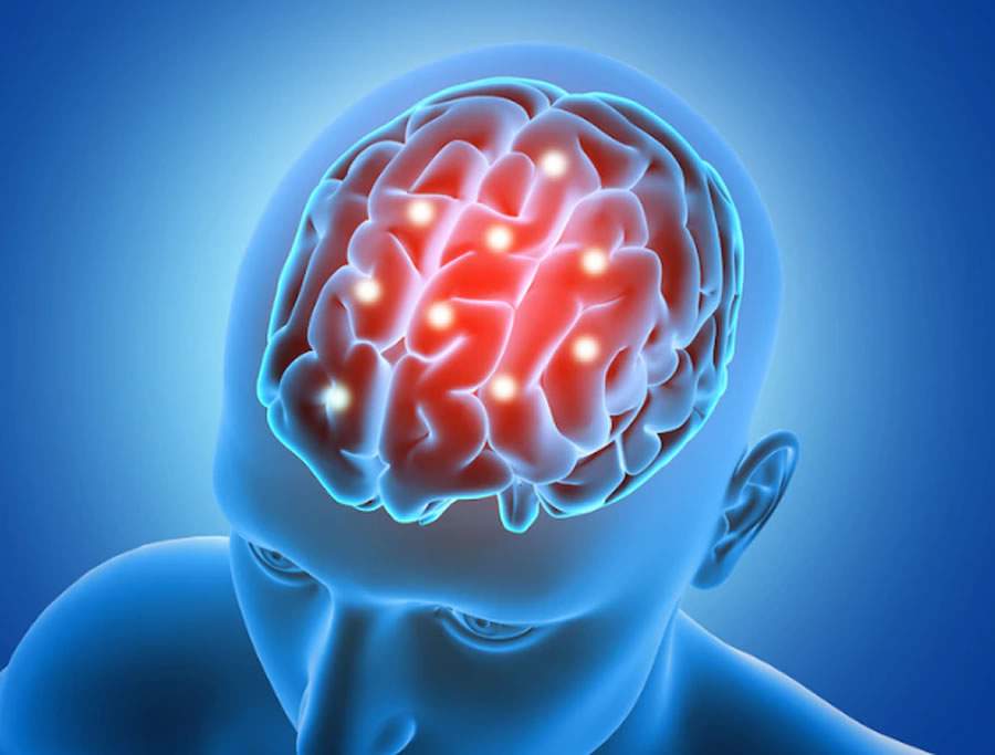 Você sabe o que é Ataque Isquêmico Transitório?