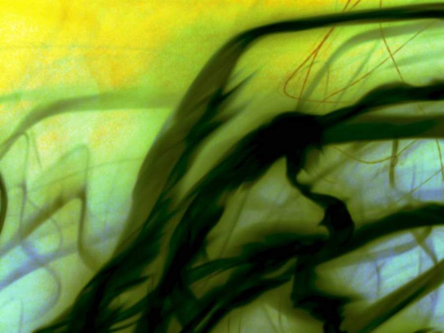 Imagem: freeimages.com