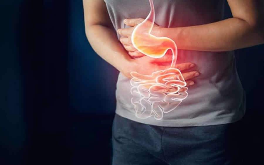 Dia Mundial da Sa&uacute;de Digestiva &eacute; em 29 de maio e gastrite &eacute; uma doen&ccedil;a que se destaca nessa data - iStock