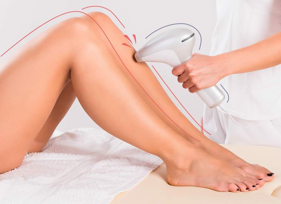 Depilação a laser: Como funciona e cuidados essenciais