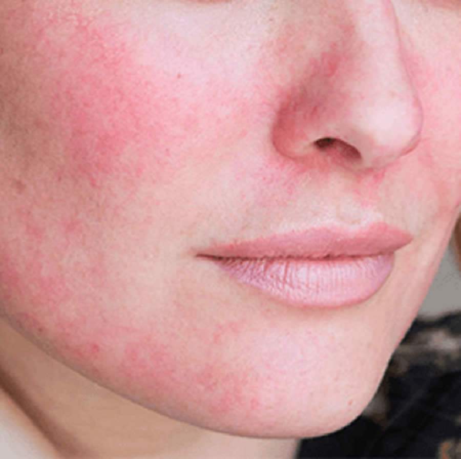 Cr&eacute;ditos - Foto: Divulga&ccedil;&atilde;o / MF Press Global