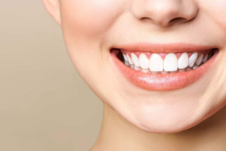 Clareamento dental: conhe&ccedil;a os tipos e os cuidados