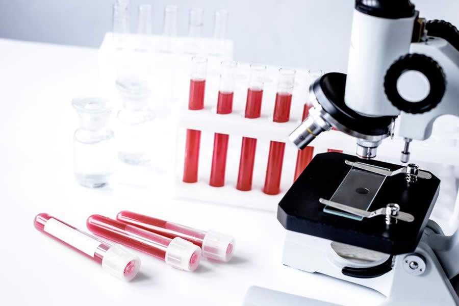 Doen&ccedil;as no Sangue: Saiba mais sobre a composi&ccedil;&atilde;o sangu&iacute;nea e quais as suas principais enfermidades