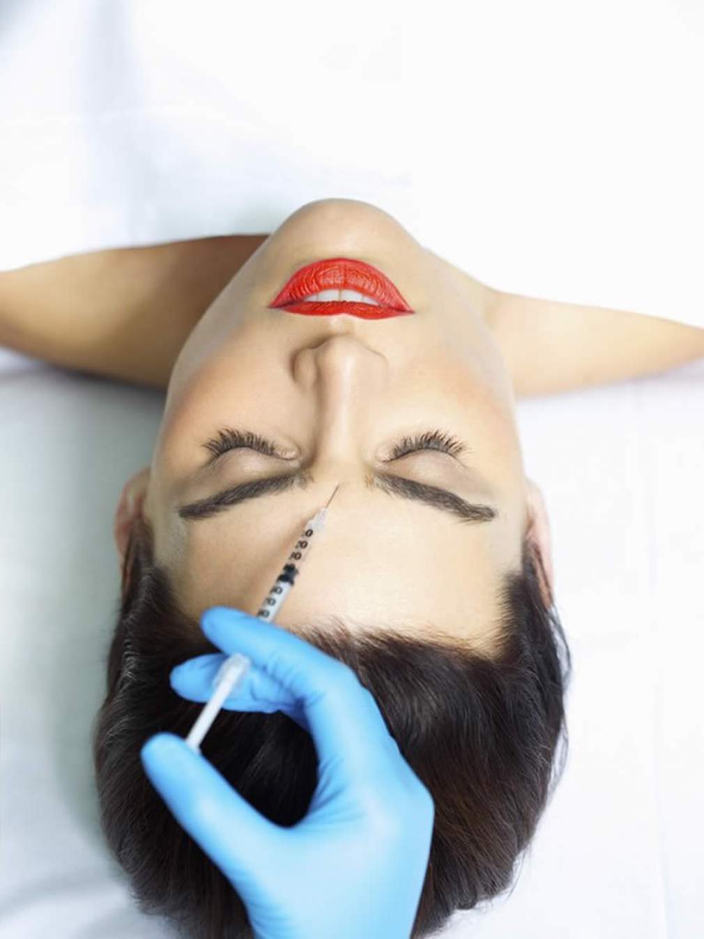 Litlift: tendência oferece otimização facial com efeito natural, por meio de preenchimento e 'botox'