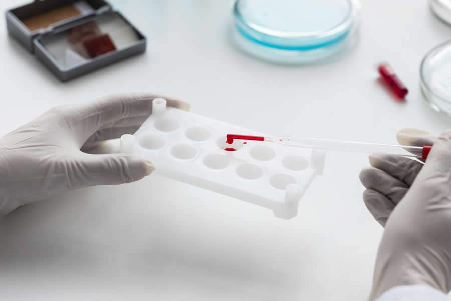 Formas silenciosas de malária: infecções assintomáticas dificultam diagnóstico e erradicação da doença