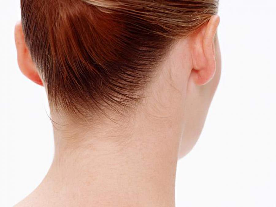 Manchas na pele podem se tornar uma grande dor de cabeça no verão