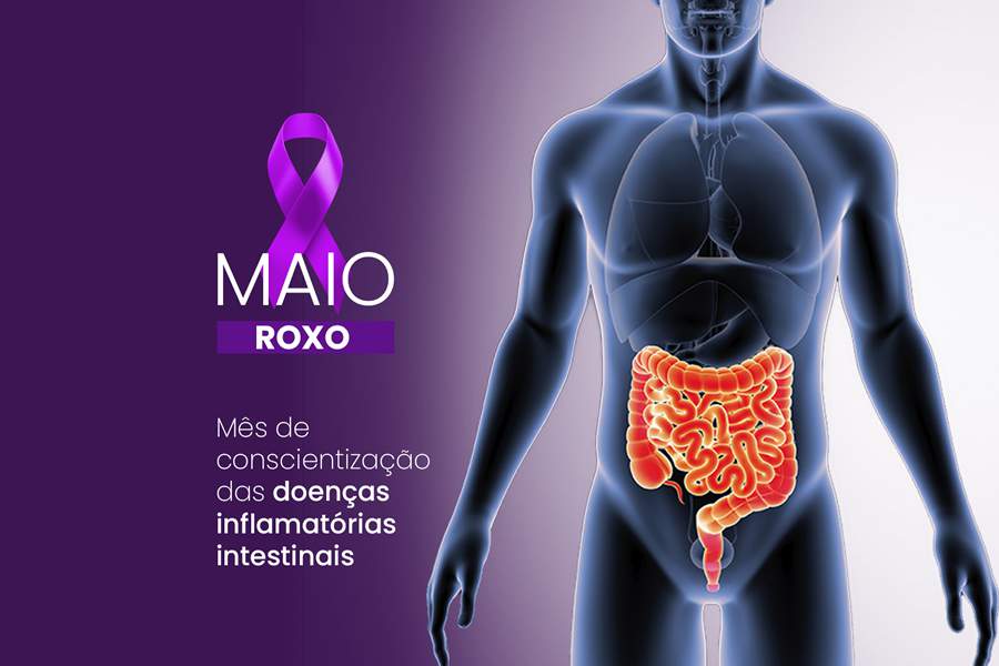 O Maio Roxo visa sensibilizar a sociedade para a importância do diagnóstico precoce das Doenças Inflamatórias Intestinais (DIIs) - Divulgação
