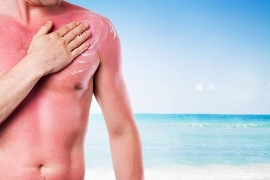 Cuidados com a pele: risco de câncer aumenta no verão