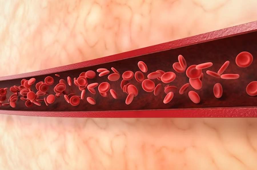 A trombose é a formação de coágulos dentro da circulação das artérias ou veias. O Dia Nacional de Combate e Prevenção à doença é em 16 de setembro - Freepik