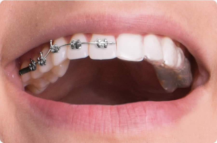 Smilink - Divulga&ccedil;&atilde;o