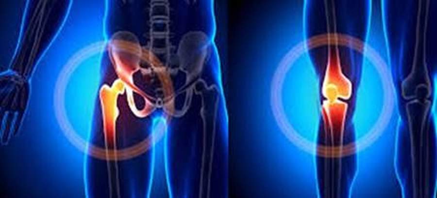 Dores e rigidez nas articula&ccedil;&otilde;es do joelho e quadril?