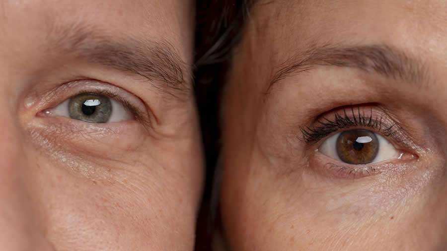 ALERTA: Doença crônica também é fator de risco para cegueira