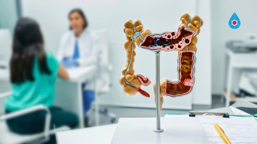 Teste revolucionário para o tratamento de câncer de intestino