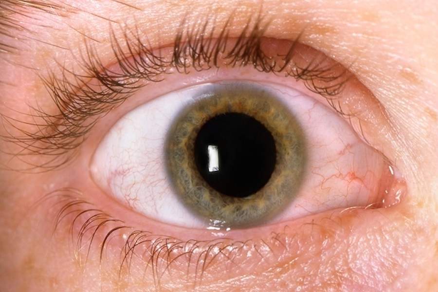 O glaucoma é a principal causa de cegueira irreversível do mundo. - Divulgação | Faculdade Santa Marcelina | ShutterStock