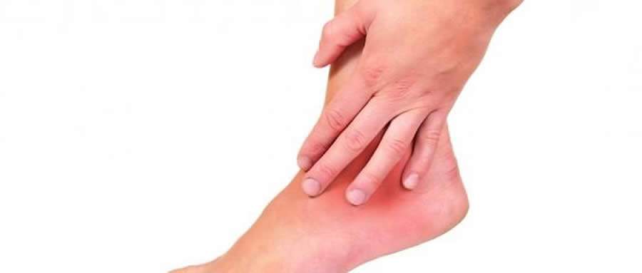 Conheça simples exercícios que minimizam o risco de desenvolver trombose durante a quarentena