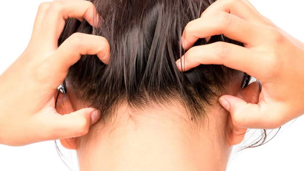 8 problemas que podem causar sensação de formigamento no couro cabeludo