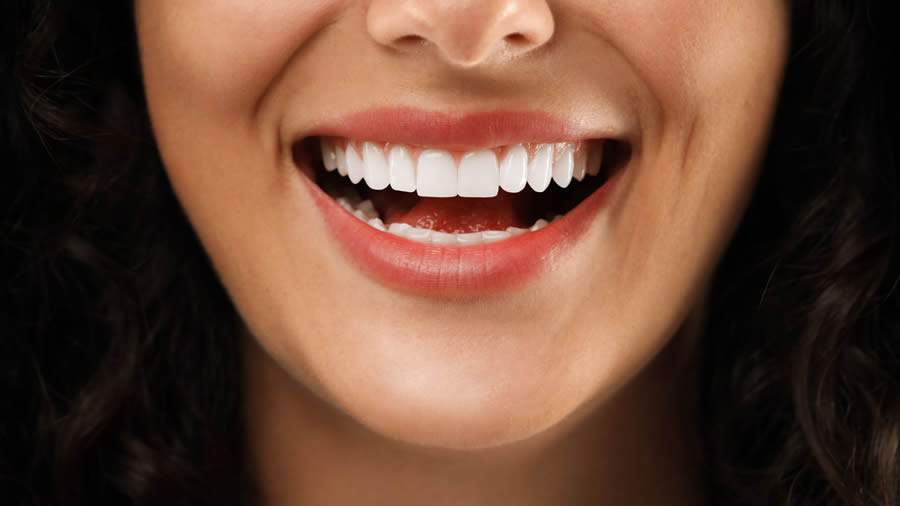 Sorriso branco no verão: 5 mitos e verdades sobre clareamento dental