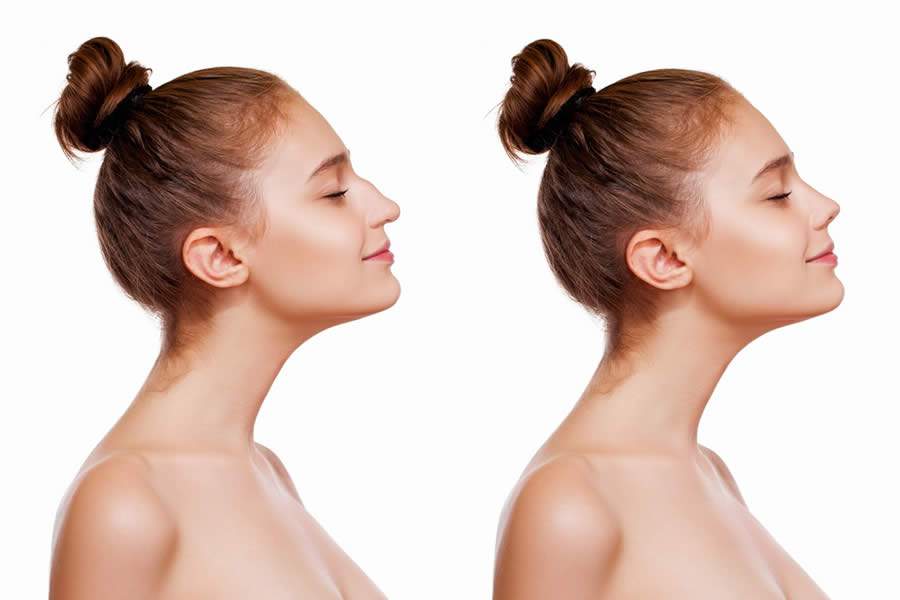 Cirurgi&atilde;o pl&aacute;stico brasileiro apresenta nova t&eacute;cnica em rinoplastia