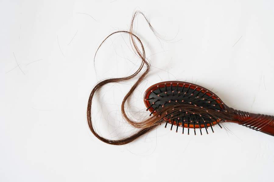 Mês de conscientização: especialista explica sintomas e tratamento da alopecia areata ou &quot;pelada&quot;