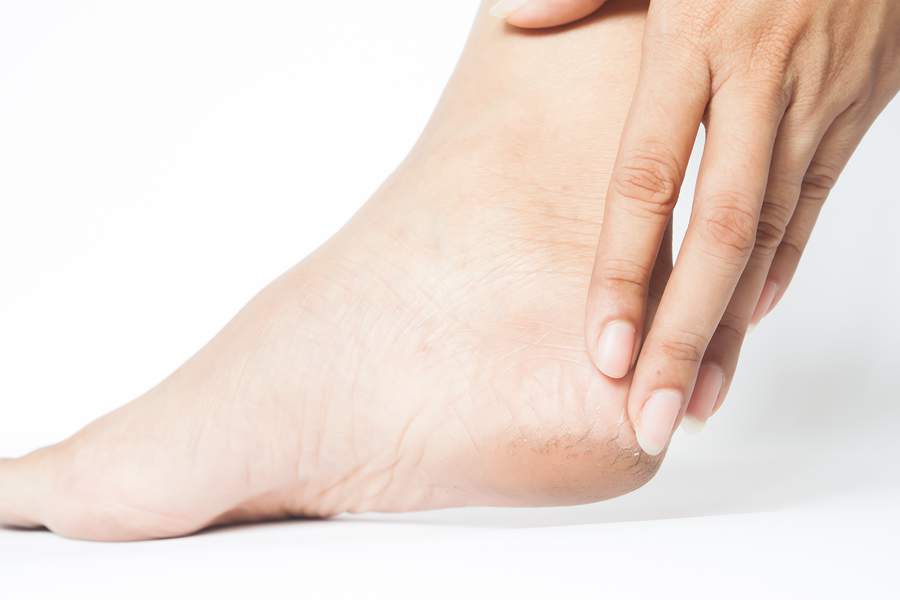 Estima-se que 25% dos pacientes com diabetes desenvolver&atilde;o pelo menos uma &uacute;lcera do p&eacute; durante a vida - Divulga&ccedil;&atilde;o