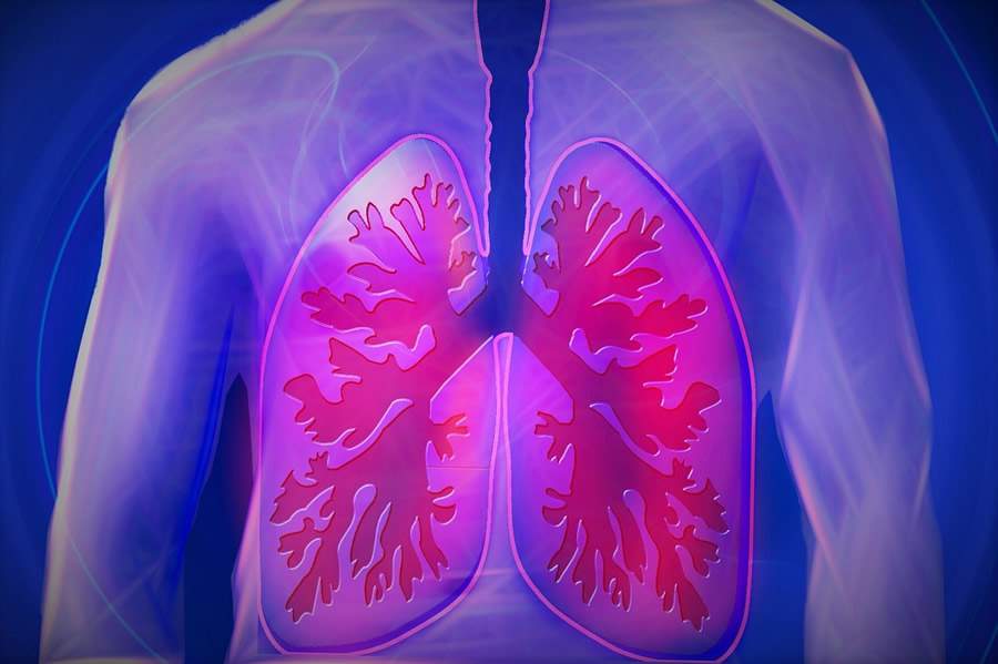 Novidades no tratamento do câncer de pulmão_Pixabay